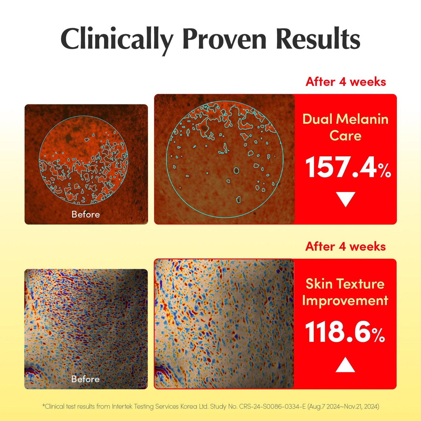 Vitamin Illuminating Serum – Brightening Vitamin C Serum with Niacinamide | Strengthens skin barrier | Hydrates using Ceramide and Hyaluronic Acid, 1.01oz / 30ml