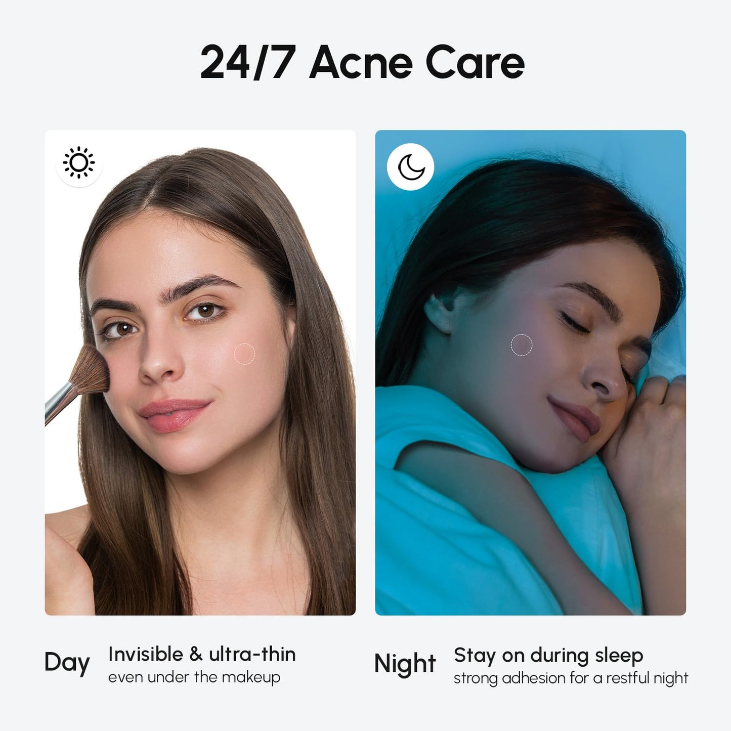 MAREE Pimple Patches for Face - Acne Clearing Device - Clear Acne Patches for Face - Invisible Hydrocolloid Patch Parches Para Acne Stickers Zit Dots - Cystic Zit Healing Blemish Pinple Covers
