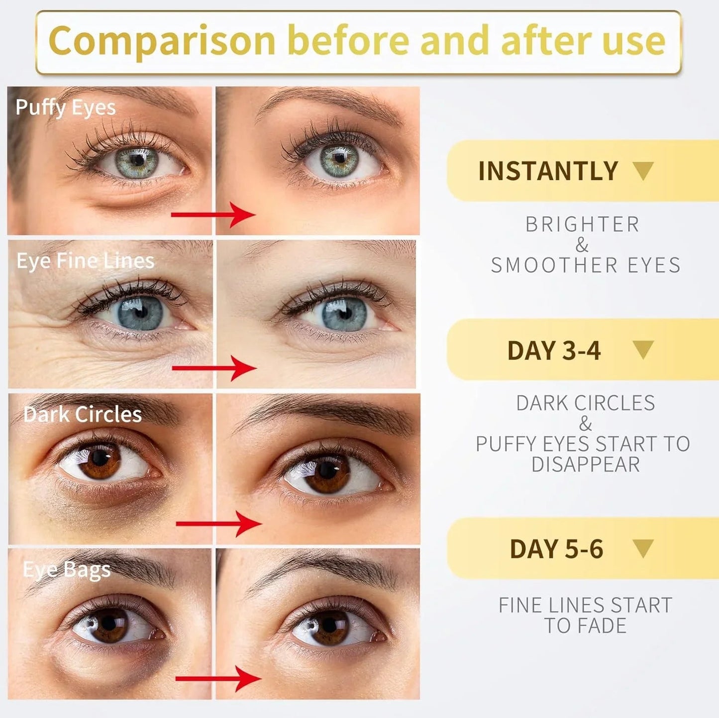 24K Gold Under Eye Patches – 60pcs for Dark Circles, Puffiness & Wrinkles Care - Cart Shape
